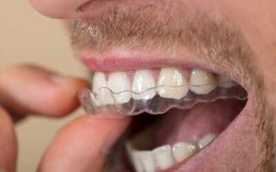 Bettskena – det effektiva verktyget som motverkar tandgnissling